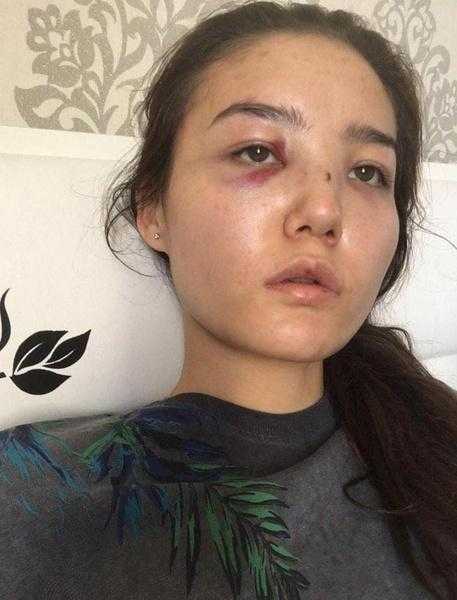 Советник посла Казахстана, избивавший жену, хотел замять дело: «Скажи, что сама себя ударила лицом об дверь»