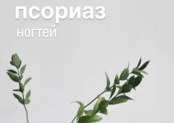 Псориаз ногтей