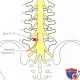Специальные тесты пояснично-крестцового отдела позвоночника Рисунок 1. Задне-наружное выпячивание диска L4— L5 может вызвать…