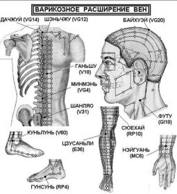 Варикозное расширение вен (звёздочки ) Спина VG14 Да-чжуй под остистым…