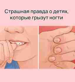 Страшная правда о детях, которые грызут ногти Дети грызут ногти не от вредной привычки….