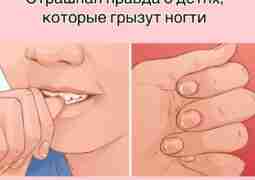 Страшная правда о детях, которые грызут ногти Дети грызут ногти не от вредной привычки….