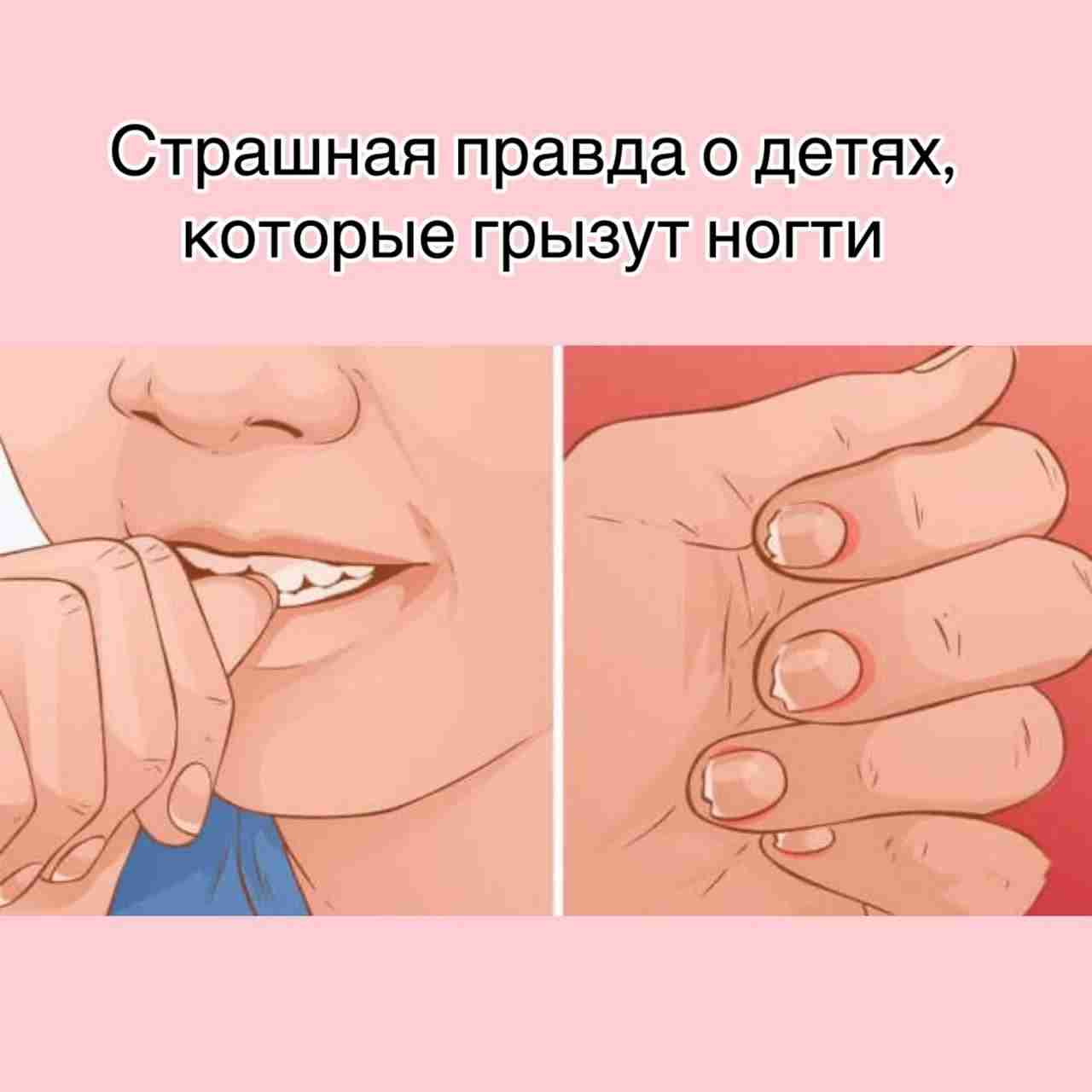 Страшная правда о детях, которые грызут ногти Дети грызут ногти не от вредной привычки….